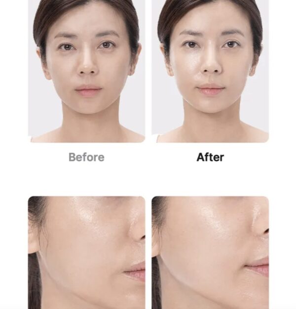 Age R-Booster Pro de Medicube - 1 Pieza